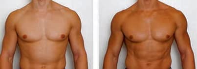 Self-Tanning Mousse + Instant Bronzer – Streak-Free Golden Glow in 1 Hour No Orange by Bronzo Sensuale 5 Fl. Oz.