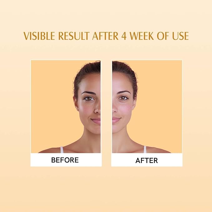 Ar.avi Org.anic Spf 50 Glow Sunscreen For All Skin Type Stick - Broad Spectrum - With Pa++++ Uva &amp Uvb Protection With No White Cast - For Men &amp Women - 13 Gm