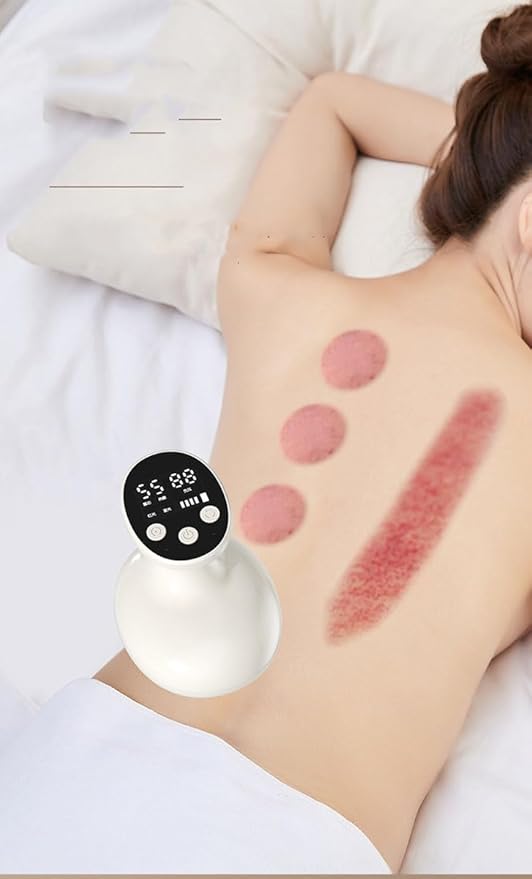 Electric Cupping Therapy Massager Machine Handheld Suction Massager with Adjustable Electric Cupping Massager for Body Reduce Muscle Pain