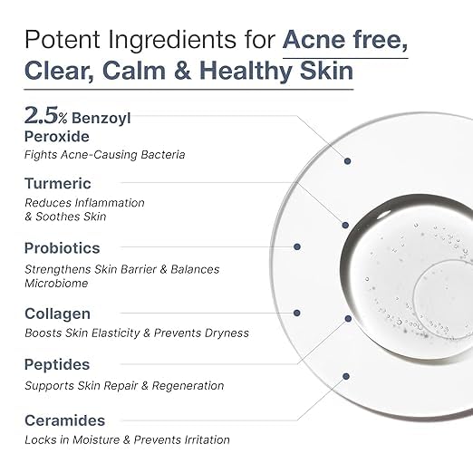 Wild-Oak 2.5% Benzoyl Peroxide Acne Face &amp Body Wash | For Back Acne &amp Breakouts | Unclogs Pores | Turmeric + Ceramides | Non-Drying Daily Cleanser | 450ml