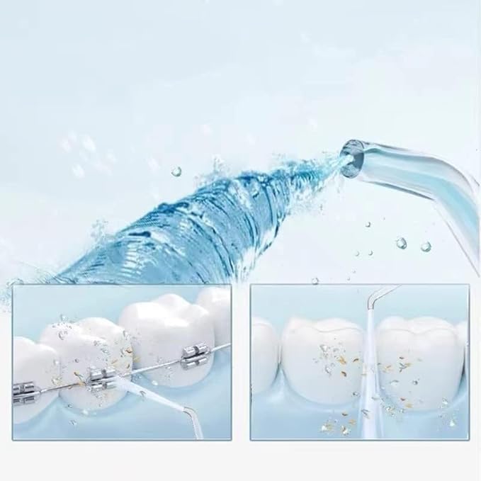 Portable Oral Irrigator Deep Cleans and Whitens Teeth Waterproof Water Flosser Rechargeable for Travel Use(Blue)