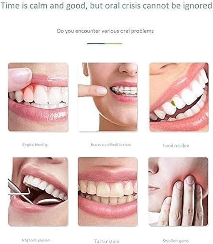 Water Flosser - Cordless Dental Irrigator Pick - Adult Oral Care Floss Kit - Gingivitis Treatment Orthodontic Jet Braces Bad Breath (Color : A)