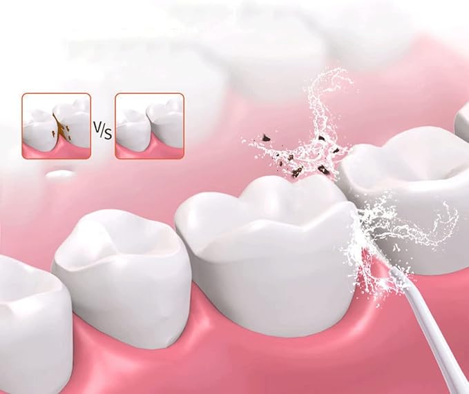 Cordless Advanced Water Flosser for Teeth Gums Braces Gums Braces Dental Care Cordless Dental Oral Irrigator - 3 Modes 3 Tips for Multiple Users and Needs(Gray)