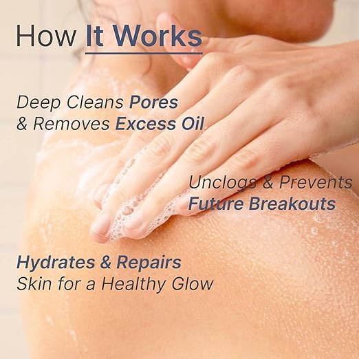 Wild-Oak 2.5% Benzoyl Peroxide Acne Face &amp Body Wash | For Back Acne &amp Breakouts | Unclogs Pores | Turmeric + Ceramides | Non-Drying Daily Cleanser | 450ml