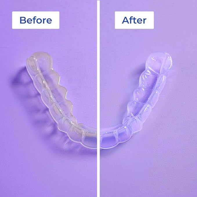 ALIGNER Cleaner Rinse | Concentrated | Clean INVISIALIGN retainers dentures Mouth Guards | 2 Month Supply (Pack of 1 - Value of 101 fl.oz) Alcohol Free Minty &amp Fresh. Made in USA - Pack of 1