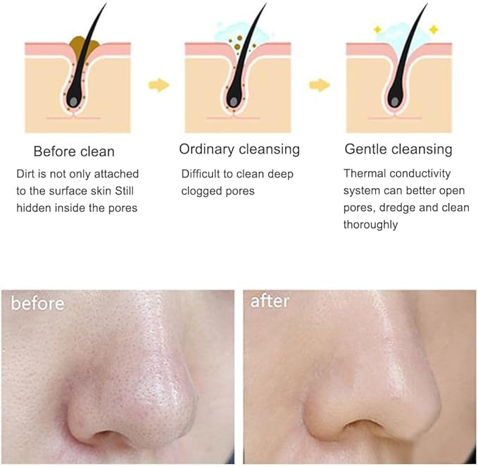 Electric Facial Cleansing Brush Silicone Ultrasonic Vibration Face Cleanser Deep Pores Blackhead Cleaning Washing Skin Massager (Color : Pink)