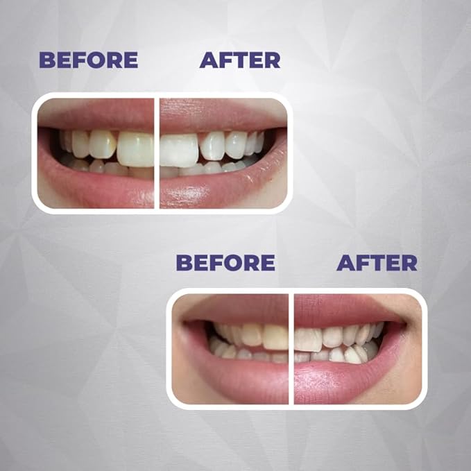 Whitening &amp Remineralization Teeth Strips and Concentrated Water flosser Rinse &amp mouthwash Teeth Care Peroxide Free. Made in USA
