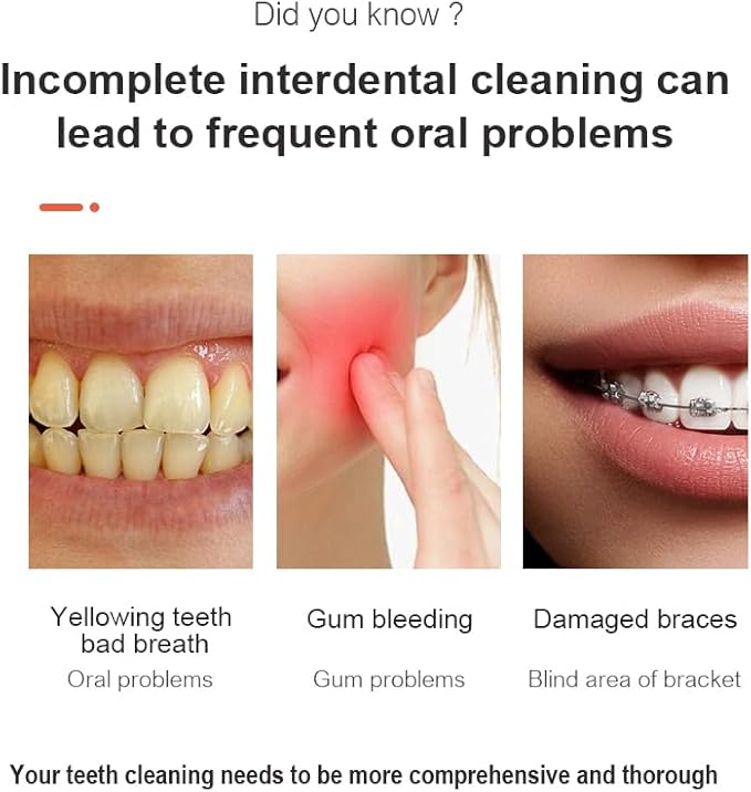 Water Flosser Cordless with 260ML Removable Tank 4 Cleaning Modes Oral Irrigator for Braces and Sensitive Gums(White)