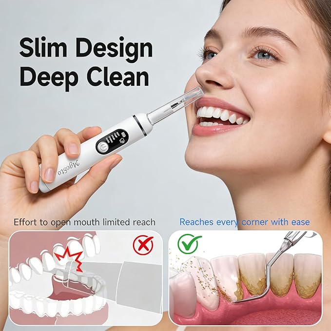 Ultimate Electric Teeth Cleaner - Ultrasonic Tooth Cleaning Violet Light Protection 316F Stainless Steel Heads 5-Speed Modes IPX6 Waterproof Oral Care Kit with 11 Accessories‌ (White)