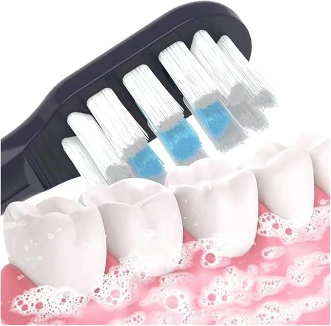 Replacement Toothbrush Heads Compatible for T301/T302/T501/MES605/MES607/MES6084/16pcs(4 Black)