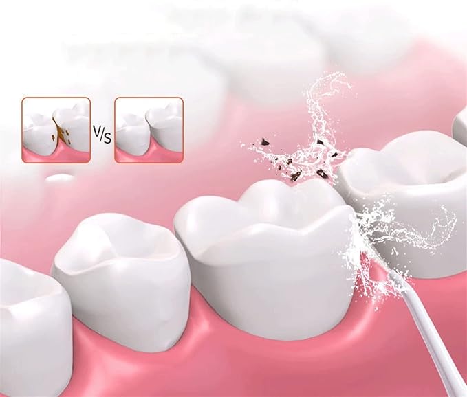 Cordless Advanced Water Flosser for Teeth Gums Braces Dental Care 3 Modes Rechargeable Portable and Waterproof (Color : F)
