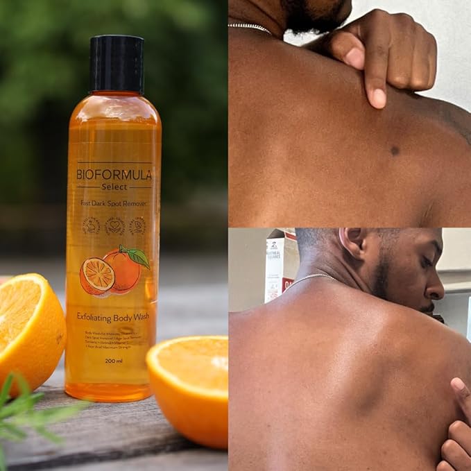 The Fast Dark Spot Remover Body Wash by BioFormula Select