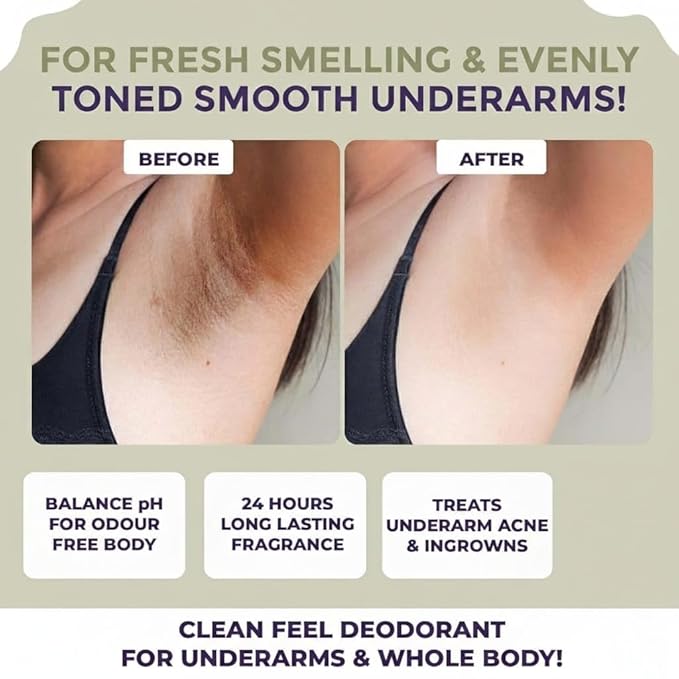 Underarm Lightening Roll On For Women | Lightens &amp Remove Pigmentation | Glycolic Acid Lactic Acid Salicylic Acid &amp Vitamin C | Deodorant for 24 Hour Long Lasting Freshness | Ingrown Hair |
