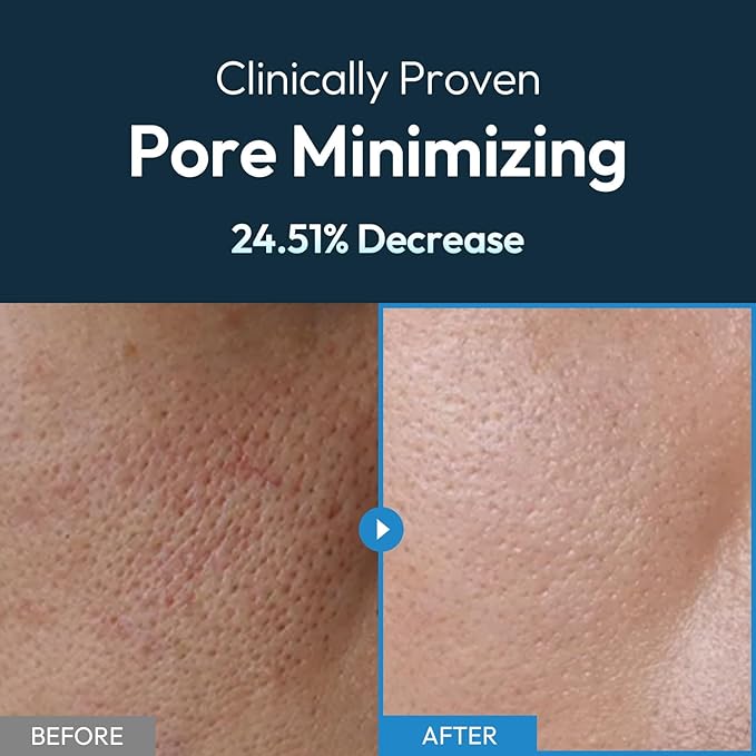 Men's Face Moisturizer - Hydrating Water Gel &amp Pore Minimizer - Non-Greasy Fast-Absorbing Oil Control Daily Face Lotion for All Skin Types - 3.71 fl oz