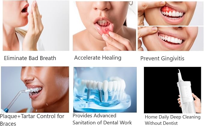 Water Flosser Oral Irrigator – Living Ozone™ US Patented TechnologyTraditional Water Flossers Rinse. We Disinfect Gums Portable for Home &amp Travel 20 Days Usage/Charges. Chemical Free.