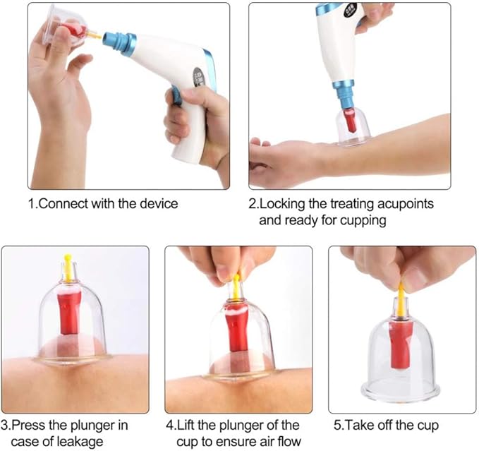 ELQ Electric Vacuum Cupping Set Body Cupping Therapy Kit for Anti Cellulite Body Lymph Drainage Pain Relief Massage