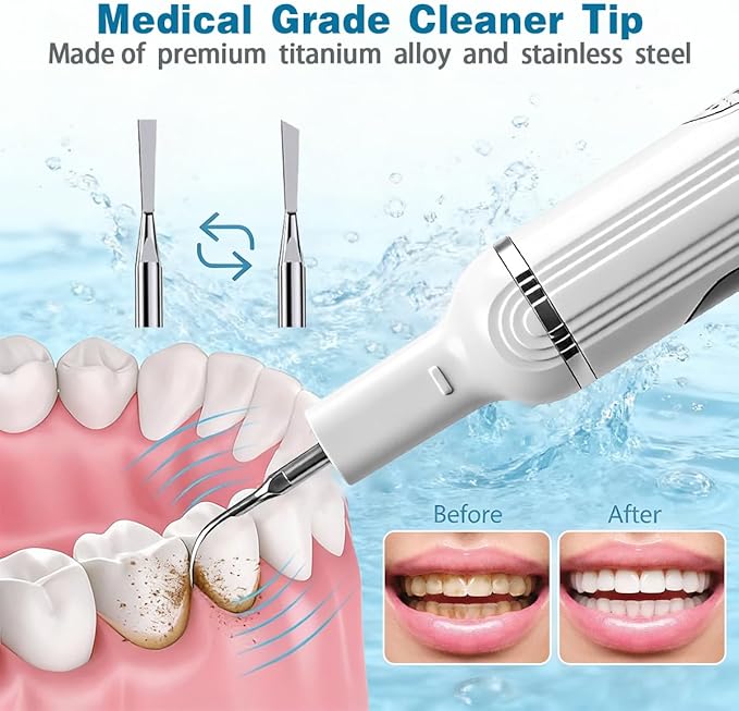 Ultimate Electric Teeth Cleaner - Ultrasonic Tooth Cleaning Violet Light Protection 316F Stainless Steel Heads 5-Speed Modes IPX6 Waterproof Oral Care Kit with 11 Accessories‌ (White)