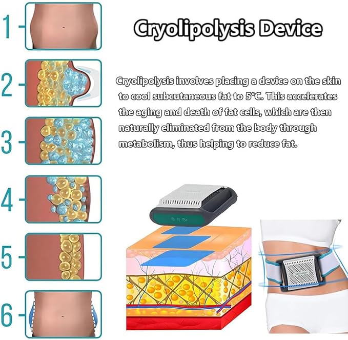 Cryolipolysis Device30/60 Minute TimerWith Hip BeltPortable Cryolipolysis DeviceNon-Invasive MassageSimple And Easy To UseFor AbdomenArmsLegs And Back