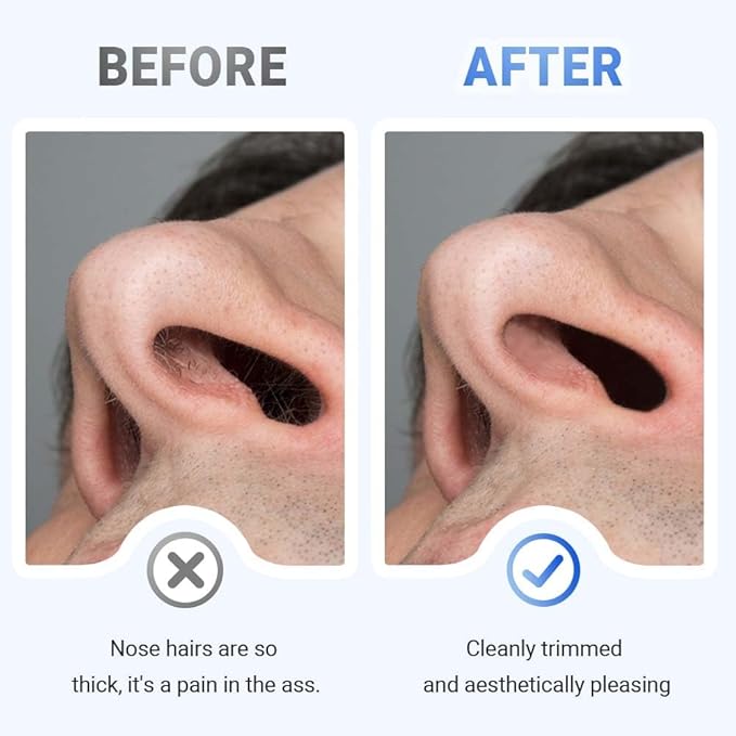 2026 Upgraded 2-in-1 Manual Nose Hair Trimmer &amp Ear Cleaner for Men and Women - 360° Rotating Dual-Blade Nose Hair Cutter Portable and Reusable Beige (10 Pack)