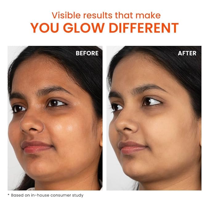 Aqua-Gel Sunscreen SPF 50 PA++++ for Oily Skin | In-Vivo Tested | 100% New-Gen UV Filters | Prevents Tan | Controls oil Cools &amp Mattefies | For oily combination &amp normal skin | For Men &amp