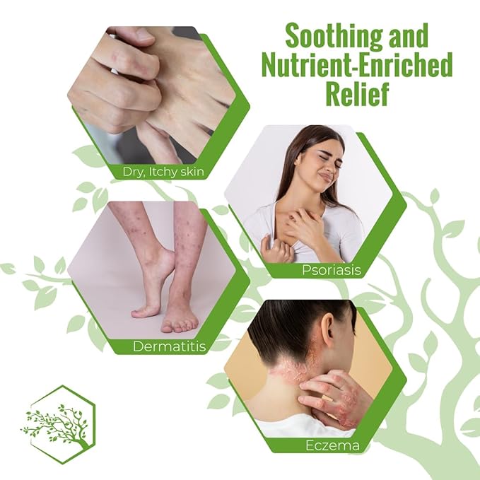 Wild Naturals Moisturizing Eczema Body Wash – Gentle Psoriasis Body Wash for Itchy Dry Skin Relief – Eczema Soap for Redness and Flareups – Hydrating Cleanser for Women and Men
