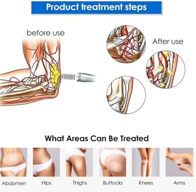 Electromagnetic Shock Wave Machine Shockwave ED Therapy MachinePortable Shock Wave Professional Pain Relief Massager Treatment Device