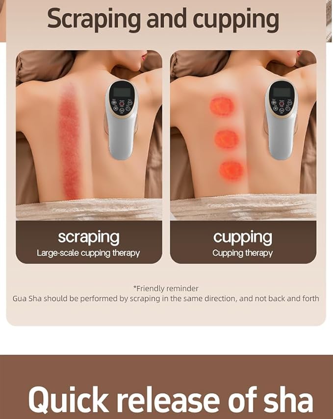 Electric Scraping Massager Heat Therapy Machine with Negative Pressure for Fat Reduction &amp Meridian Massage at Home (White)
