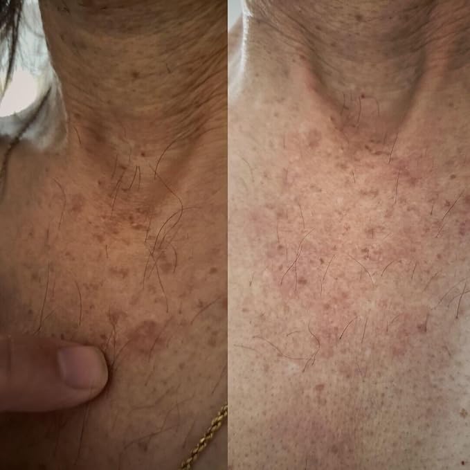The Fast Dark Spot Remover Body Wash by BioFormula Select