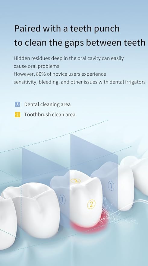 Water Dental Flosser Cordless Oral Irrigator Wireless Portable Dental Gap Oral Beautification Device 3 Cleaning Modes with 4 Customized Nozzles 1600 Times/Min High Voltage Pulse (Black)