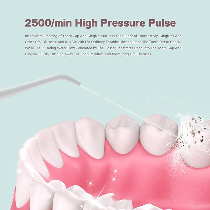 Water Flosser for Teeth CordlessOral Irrigatorwith 2500 RPM Sonic Technology3 Modes and 3 Specialised Nozzles280mlIPX7Smart Standbyfor Cleaning Teeth/Braces/GapsWhite/Green (White)