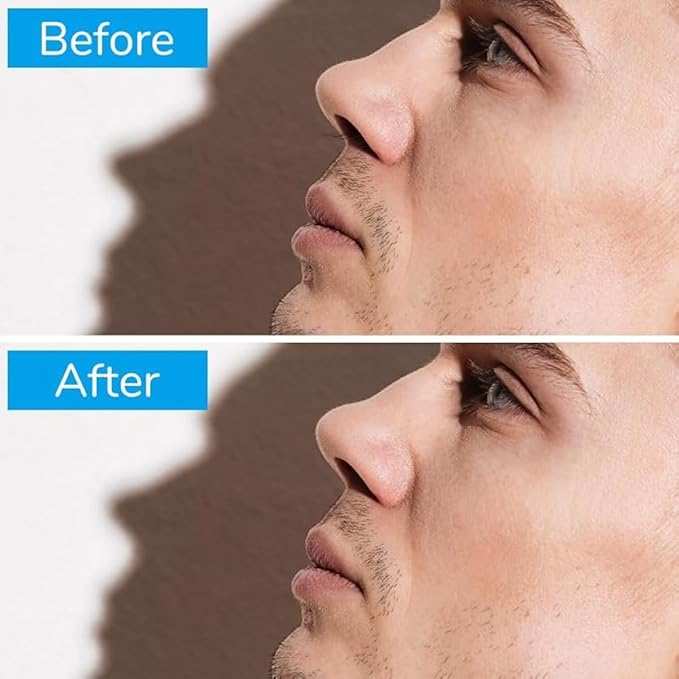 TAKE FIRE All-in-One Grooming Kit: 360° Rotating Nose Hair Trimmer for Men &amp Women with Double Sided Design &amp Ear Picker 2025 Upgraded Travel Essentials (Yellow-3PC)