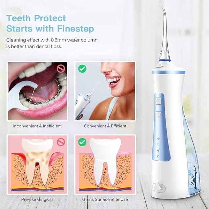 Professional Cordless Rechargeable Dental Oral Irrigator Ultra Water Jet for Teeth Braces Care IPX7 Waterproof 240ML Water Tank for Travel and Home Use