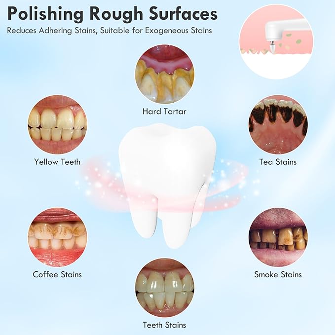 Tooth Polisher Rechargeable Teeth Polisher for Daily Cleaning Whitening and Polishing Electric Dental Teeth Polishing with LED Light 5 Brush Heads 5 Speed Modes Waterproof