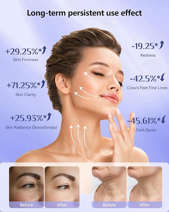 Red Light Therapy for FaceLED Face Mask Light Therapy 630nm &amp 830nm Wavelength LED Light Therapy Device for Home Use (Dark)