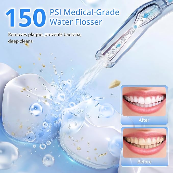 Portable Water Flosser for Teeth 100 Power Levels (0-150-PSI Variable Pressure) Mini Cordless Electric Floss for Tooth Cleaning and Flossing IPX7&amp250ML Water for Braces Aldult White