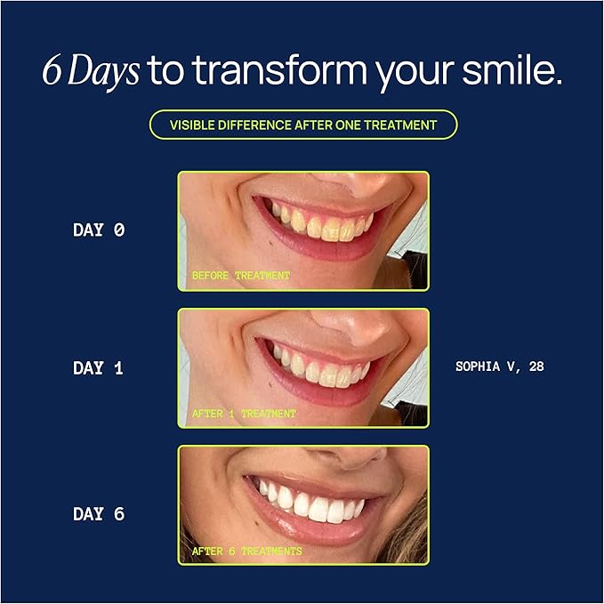 Laughland Original Teeth Whitening Gel 3 Pack Tooth Whitener Made with 8% Hydrogen Peroxide Glycerin Aloe Vera &amp Mint At Home Dental Care Travel Friendly 6 Treatments (3 Pack Original)