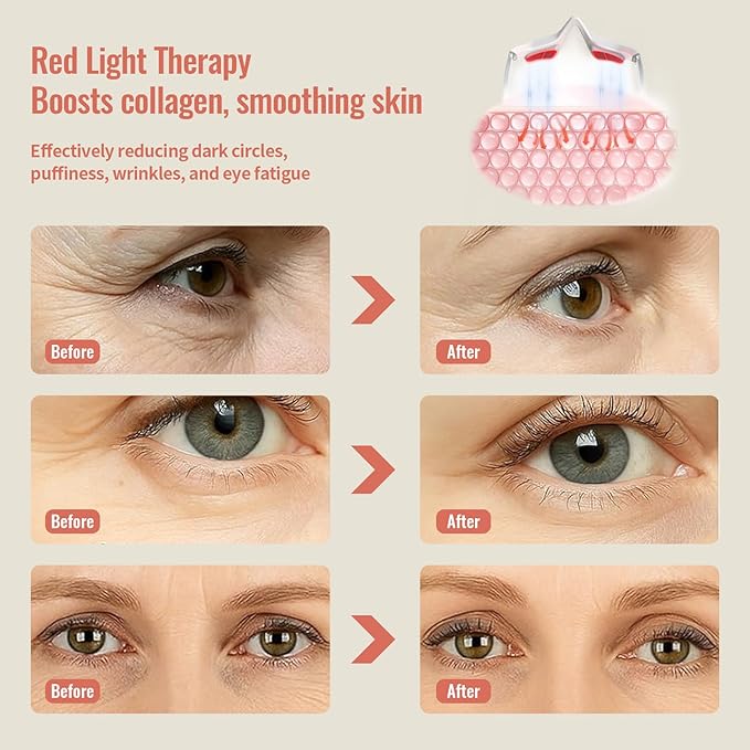 Under Eye Red Light Therapy 4 Modes Red Light Under Eye Therapy Glasses Microcurrent Eye Massager For Eye Bags Dark Circles Puffiness Wrinkles Fine Lines Relieving Eye Fatigue