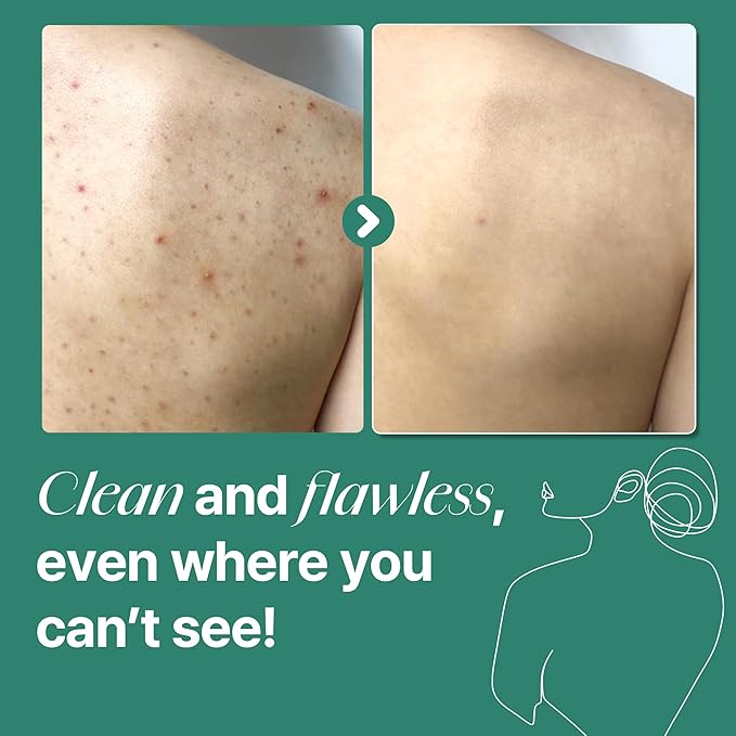 SOME BY MI AHA BHA PHA 30 Days Miracle Acne Clear Body Cleanser &amp AHA BHA PHA 30 Days Miracle Truecica Clear Pad