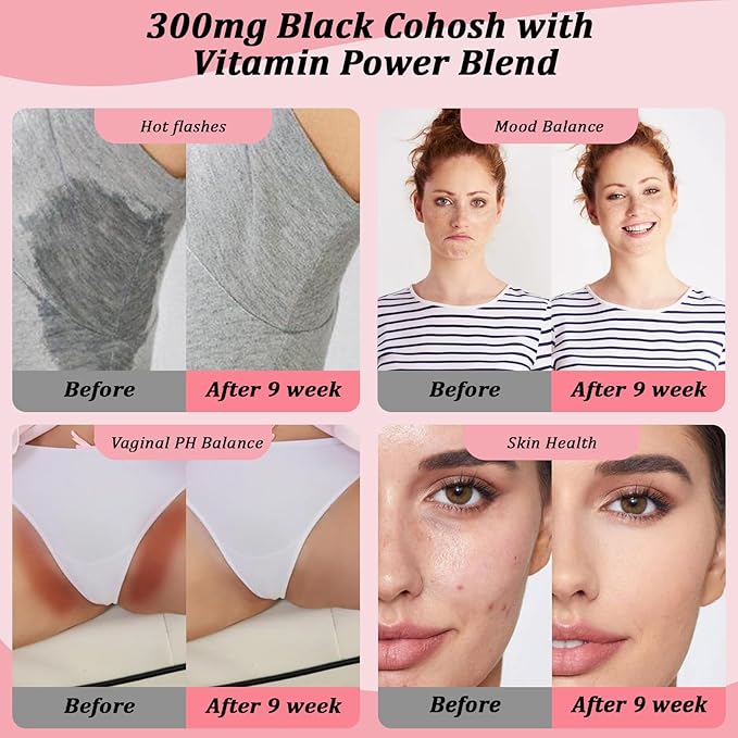 Menopause Supplement for Women : Hormone-Free Probiotic with Black Cohosh &amp Ashwagandha Support for Hot Flashes Mood Balance &amp Skin Health 60 Capsules