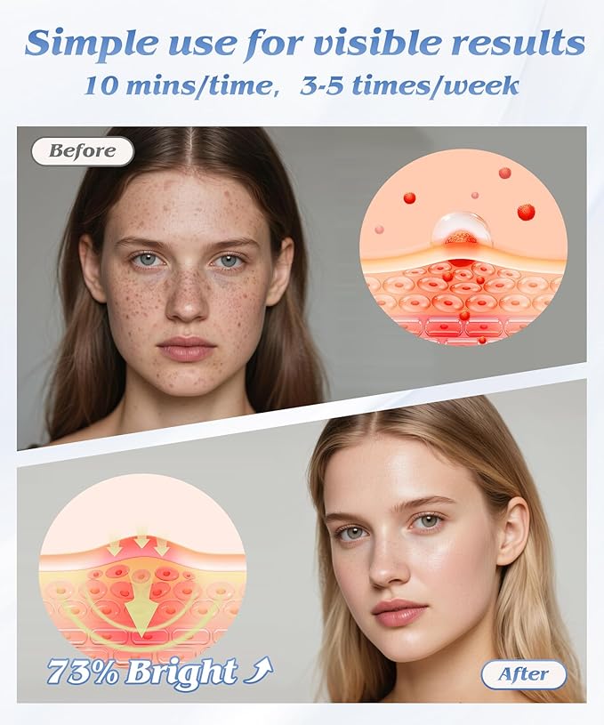 Red Light Therapy for Face Light Therapy Mask for Firming Wrinkles &amp Acne Wireless Red &amp 850nm Infrared Light Silicone Mask 7-Color LED Face Mask Portable for Use at Home &amp Travel Gre