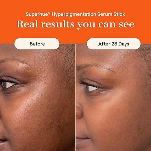Live Tinted Superhue Hyperpigmentation Serum Stick - Balm-to-Serum Stick For Face &amp Body &amp Hueguard: 3-in-1 Mineral Sunscreen Moisturizer &amp Primer for Face and Body - Travel Sized - SPF