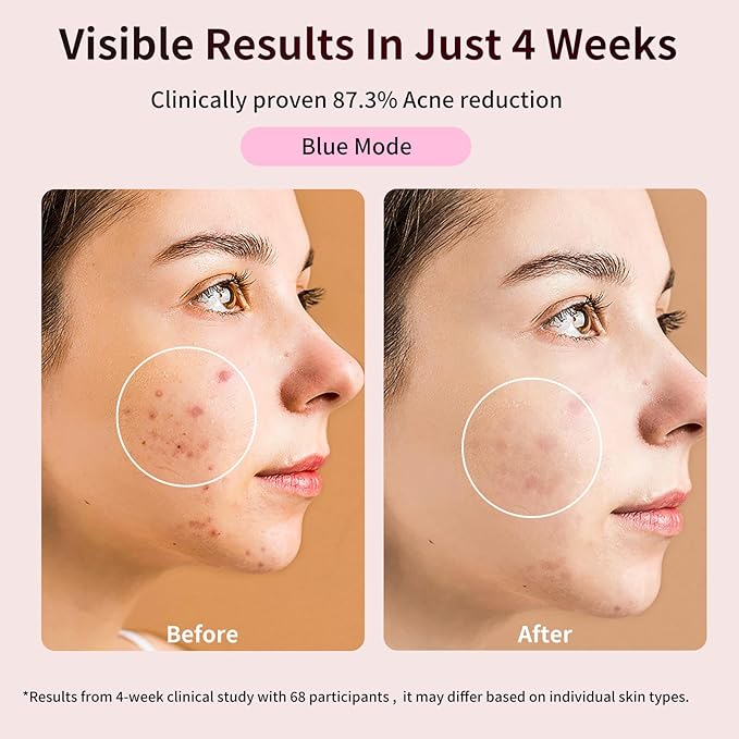 FDA-Cleared Red Light Therapy Mask for Face – 432 LEDs Full Cover Facial Device 3 Modes &amp 5 Levels 850nm Near-Infrared for Anti-Aging Wrinkles &amp Acne Rechargeable for Home &amp Travel