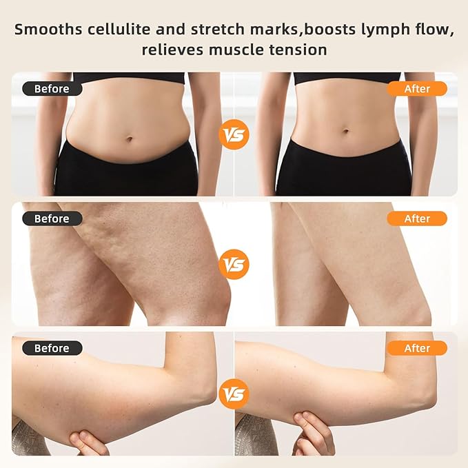 Lymph Drain Massager (Electric) – Fights Cellulite Sculpts Body! Has Heat Vibe Light &amp Microcurrent Works on Legs arms Belly Reduces Stretch Marks!(Silver)
