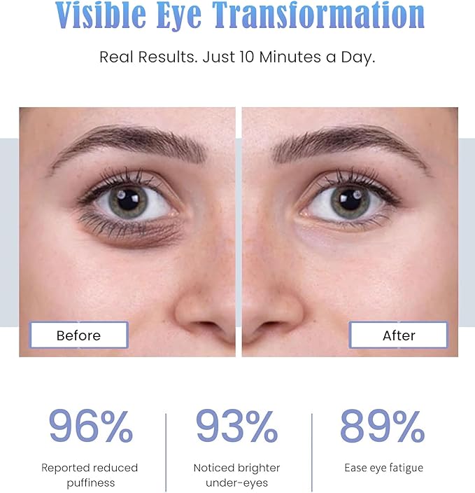 Women’s Under Eye Red Light Therapy Glasses 10 Minutes Per Day for Digital Eye Fatigue Eye Bags Dark Circles &amp Puffiness Ultra Lightweight Rechargeable Ergonomic Design