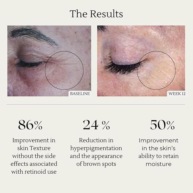 Sonrei Clearly Zinq Hydrating Tinted Facial SPF 35 + Anti-aging Growth Factor Sunscreen Mineral Gel &amp Primer | Broad Spectrum UV Protection | Water Resistant Vegan | Non-greasy with 2 REFILL 3-P