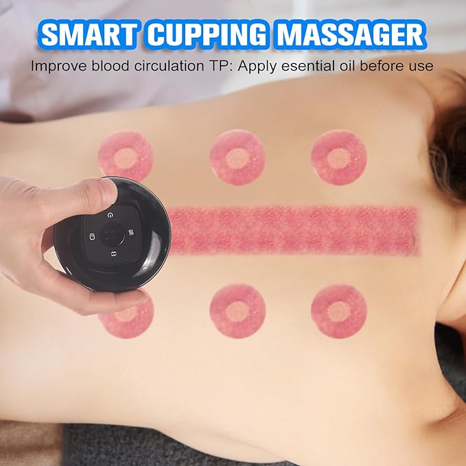 Cupping Kit for Massage (Red)