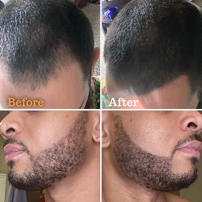 Beard Pencil Filler - BLACK - and Complete Beard Shaper Kit
