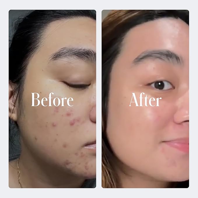 Geologie Complete Skincare Set for Men &amp Women | 1-Month Simple &amp Effective Daily Clear Skin Routine | Acne Oily Skin Dark Spots | Face Wash 2-Pack Retinol Face Cream SPF15 Moisturizer &am