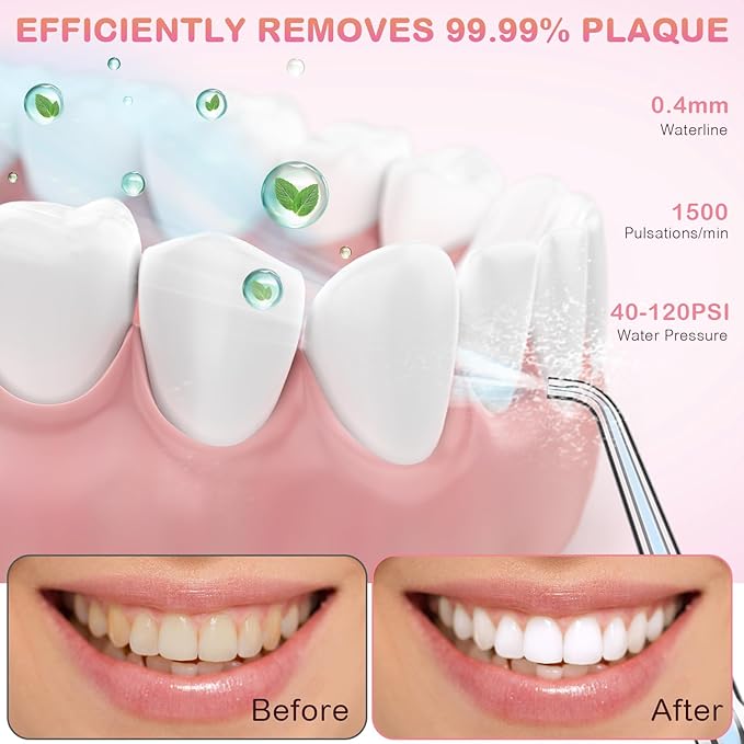 Water Dental Flosser for Teeth Cleaning and Flossing with Travel Size Case – Rechargeable Oral Irrigator KOOVON Portable Water Flosser for Adults IPX7 Waterproof 5 Jet Tips &amp 4 Modes Pink