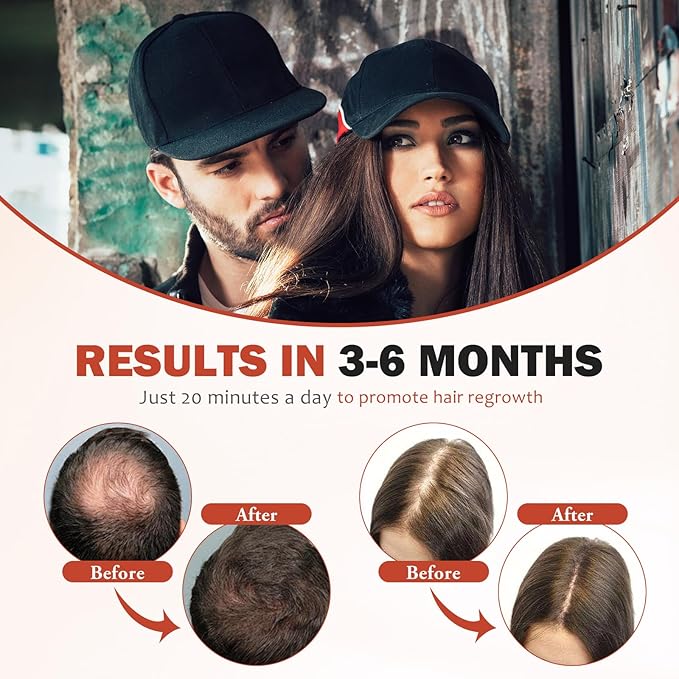 LLLT Laser Hair Growth Cap for Thinning Hair 650nm Red Light Therapy Hair Regrowth Treatment Full Scalp Coverage Hands-Free &amp Rechargeable Hair Loss Solution for Men &amp Women Black